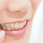 歯が痛い（一般歯科）
